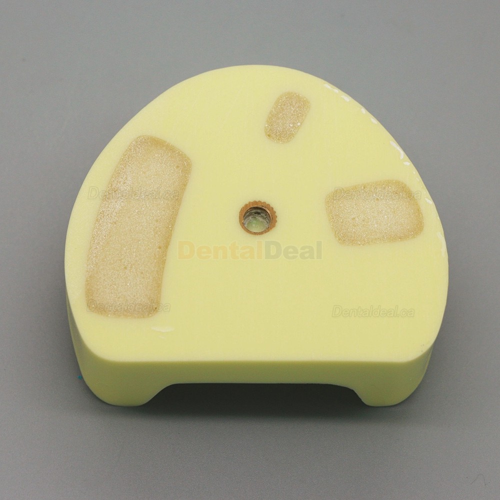 Dental Implant Model Lower Jaw Training Practice Demo Model with Gingiva #2004 01