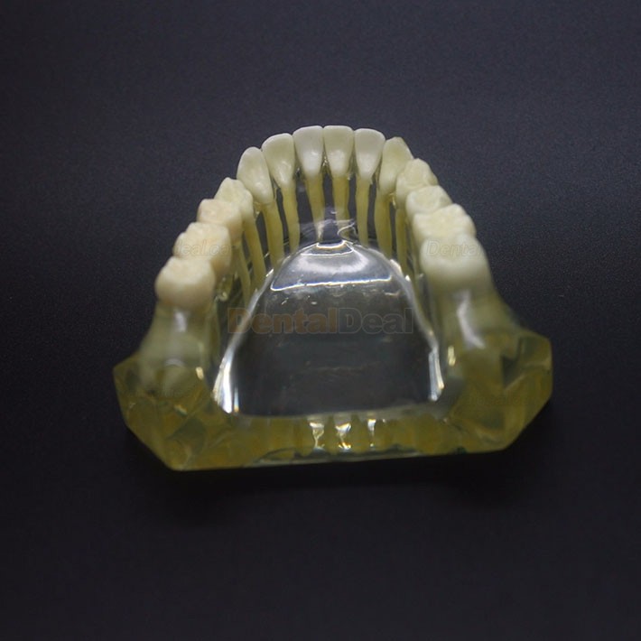 Dental Implant Study Training Demo Model Lower Jaw Crown Bridge 2010