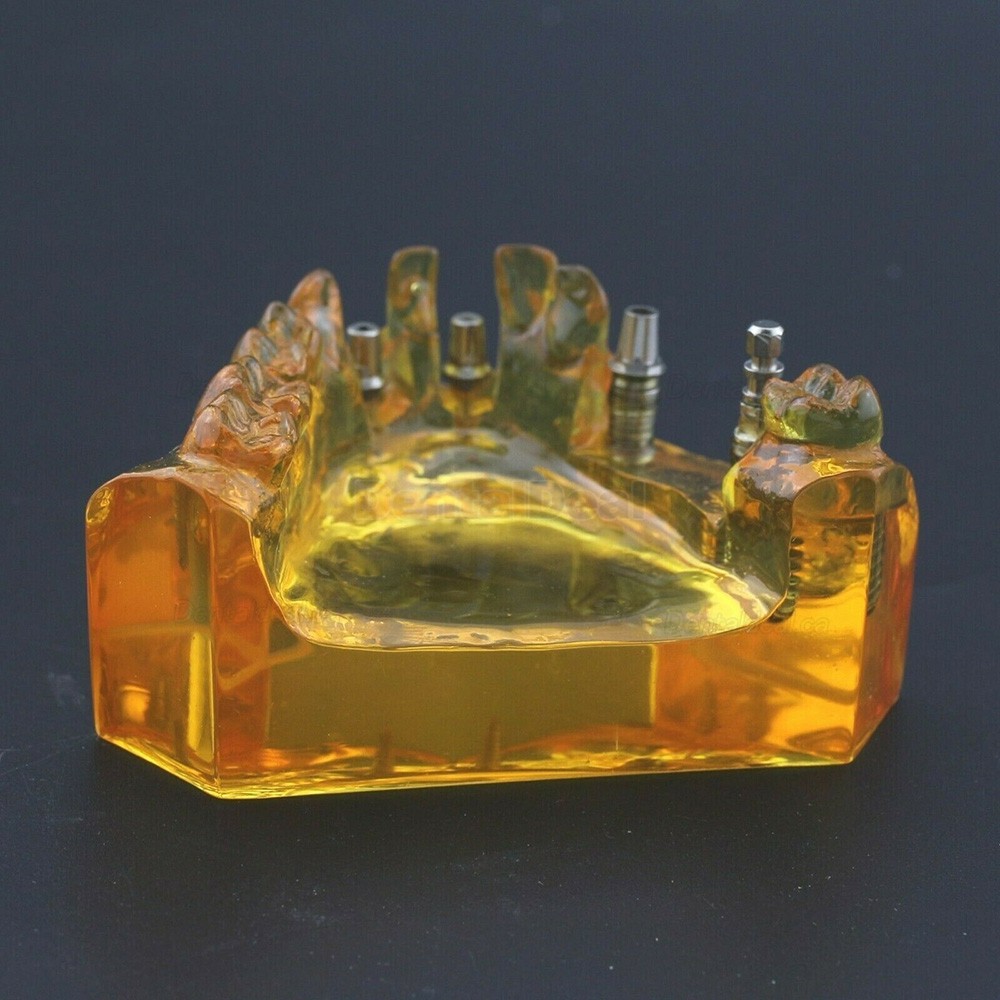 Dental Implant Typodont Teeth Model Upper Jaw Demo Model #201102