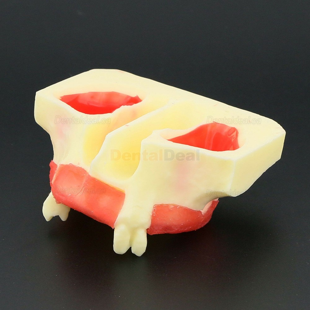 Dental Teeth Model Sinus Lift Practice Training Model Study Teaching Model 2013 01