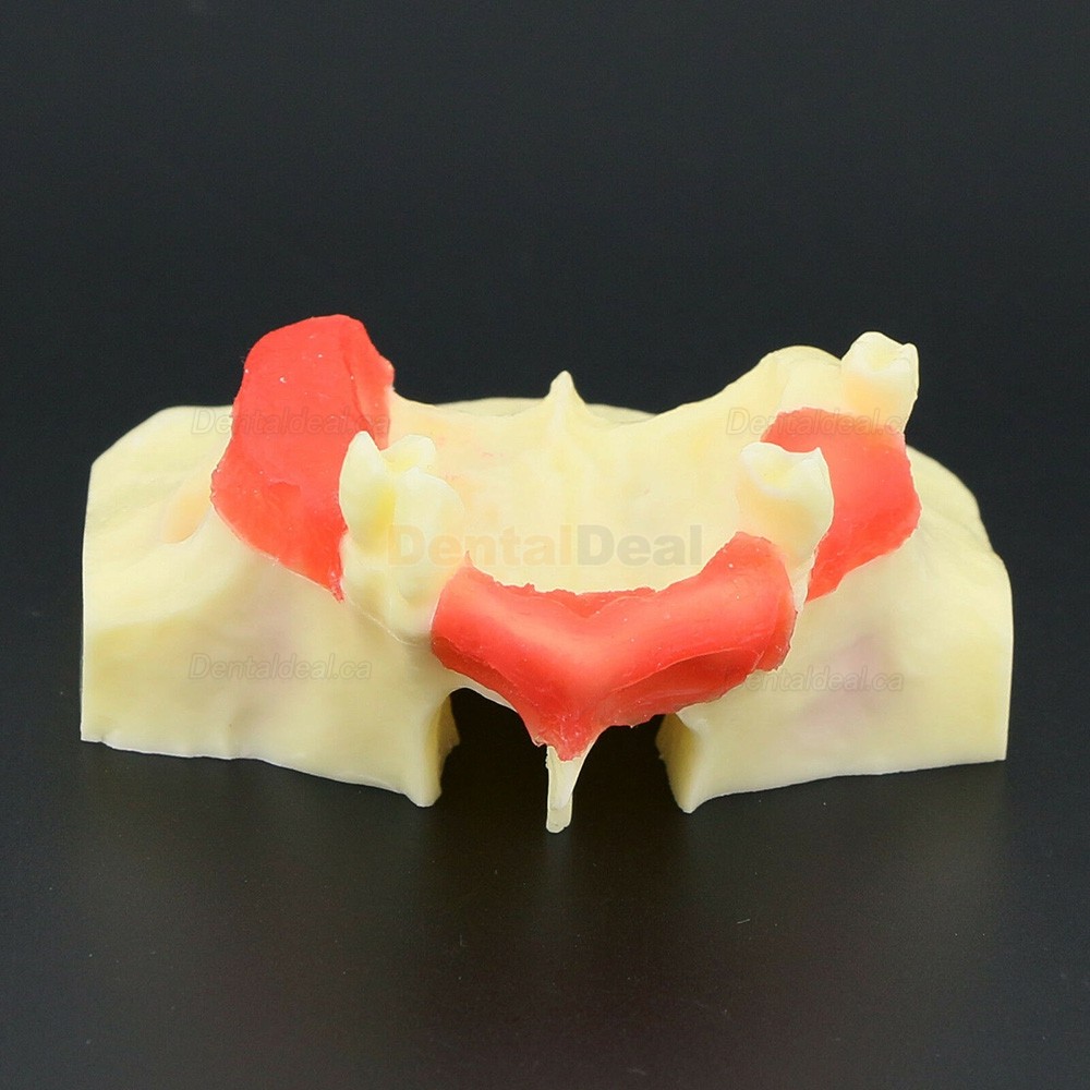 Dental Teeth Model Sinus Lift Practice Training Model Study Teaching Model 2013 01