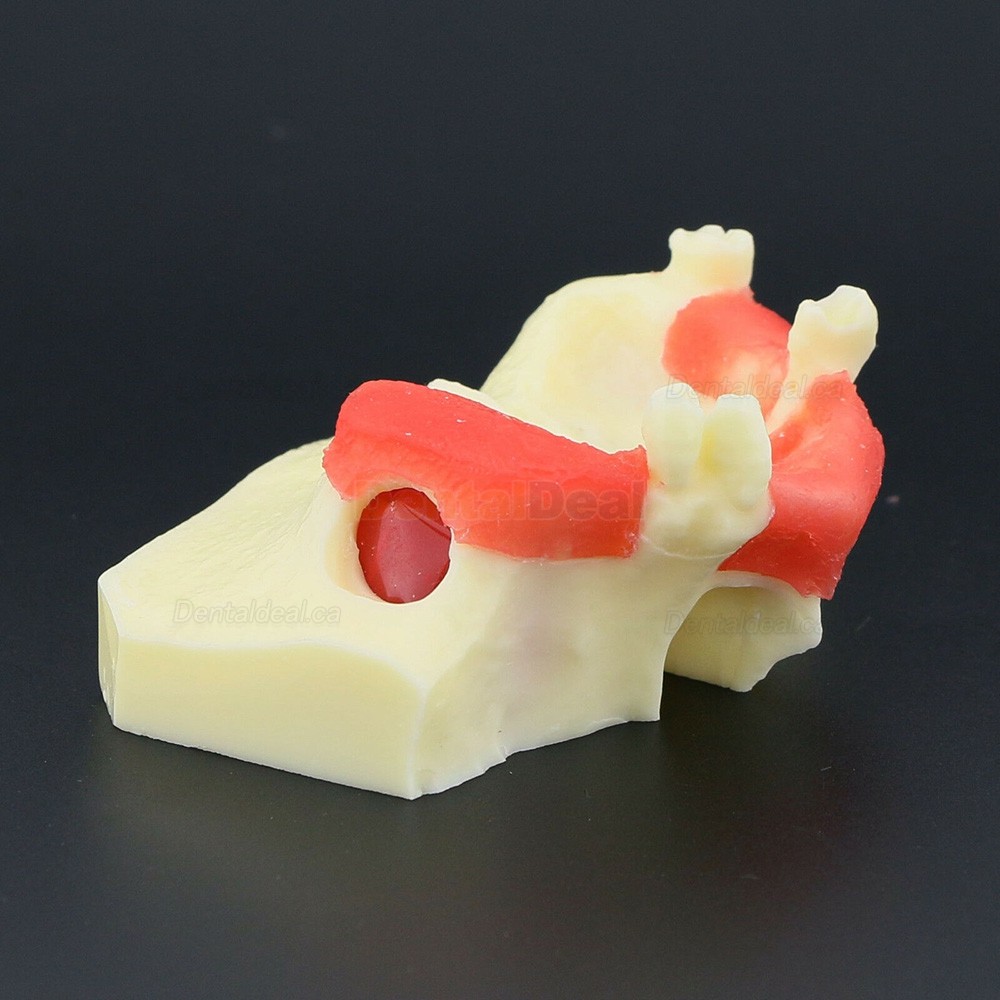Dental Teeth Model Sinus Lift Practice Training Model Study Teaching Model 2013 01