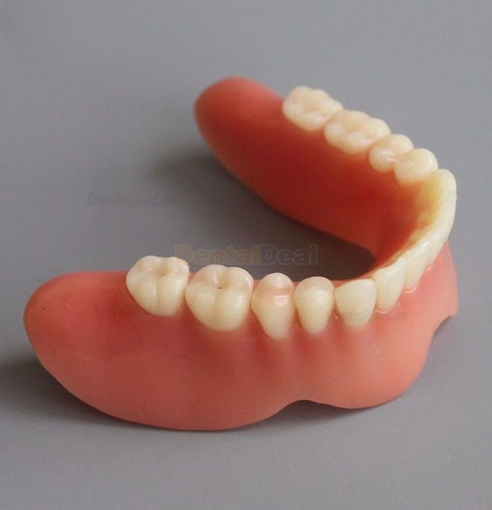 Dental Implant Overdenture Model for Study Training Demonstration #2014 02