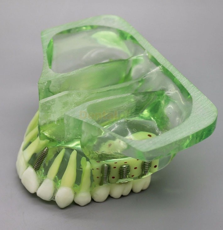 Dental Model Upper Jaw Implant Study Training Demo Model with Sinus 2015 01
