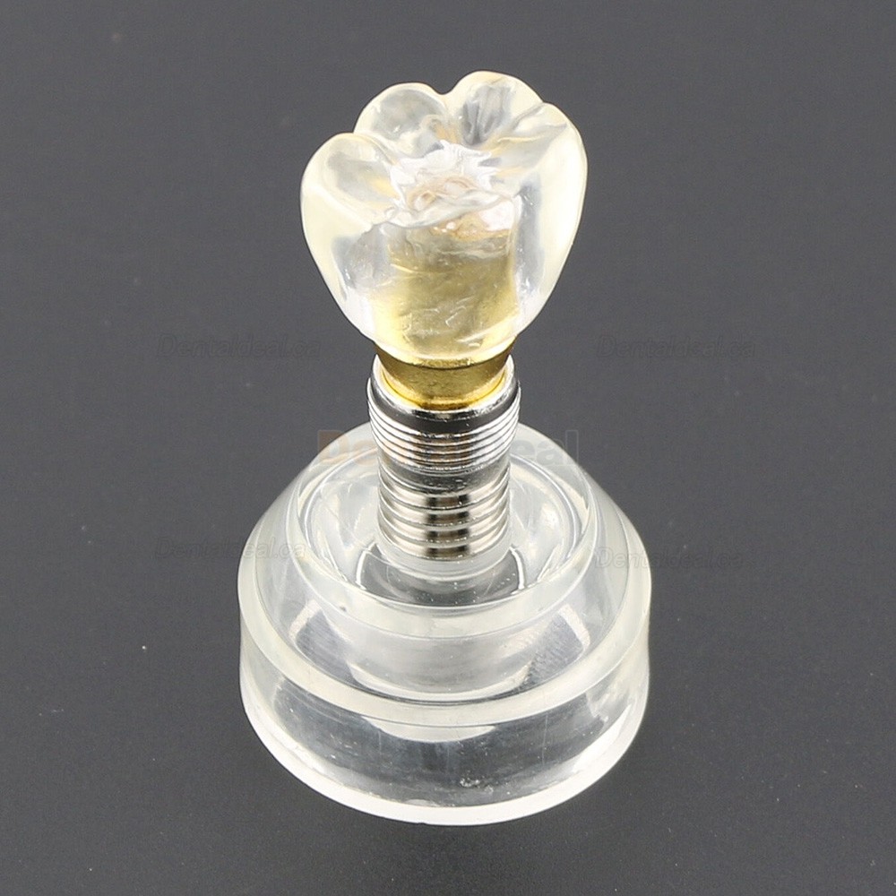 Dental Teeth Model Implant Model Demonstration Study Teach Model Demo 2020