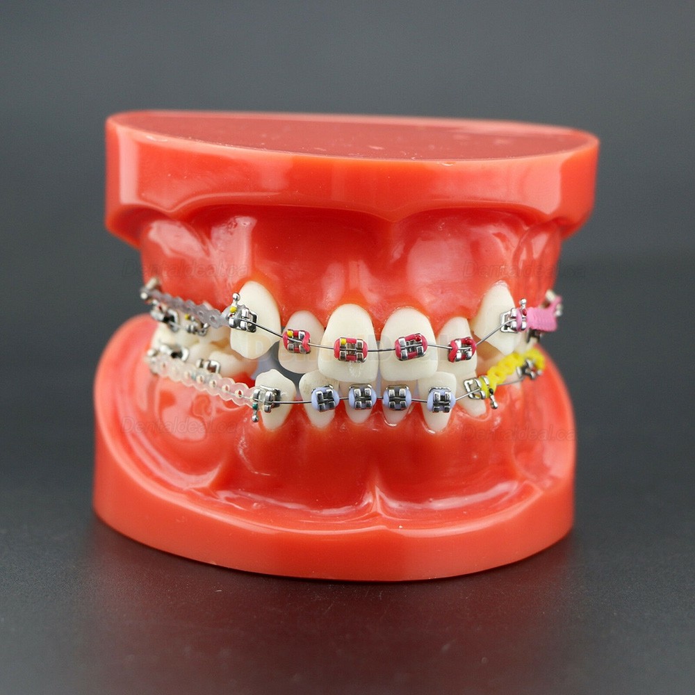 Dental Orthodontics Study Training Typodont Model With Metal Bracket Arch Wire Chain Tie 3005R