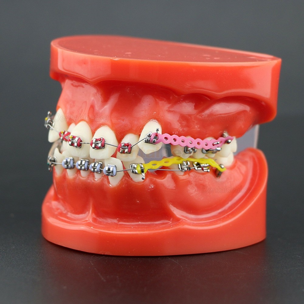 Dental Orthodontics Study Training Typodont Model With Metal Bracket Arch Wire Chain Tie 3005R