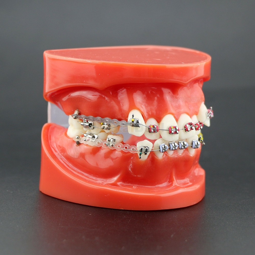 Dental Orthodontics Study Training Typodont Model With Metal Bracket Arch Wire Chain Tie 3005R