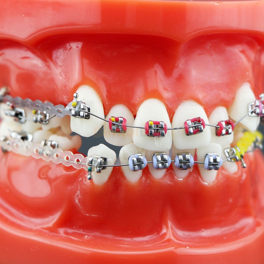 Dental Orthodontics Study Training Typodont Model With Metal Bracket Arch Wire Chain Tie 3005R