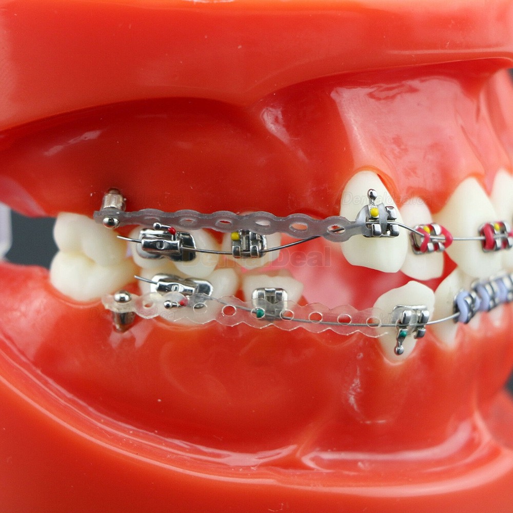 Dental Orthodontics Study Training Typodont Model With Metal Bracket Arch Wire Chain Tie 3005R