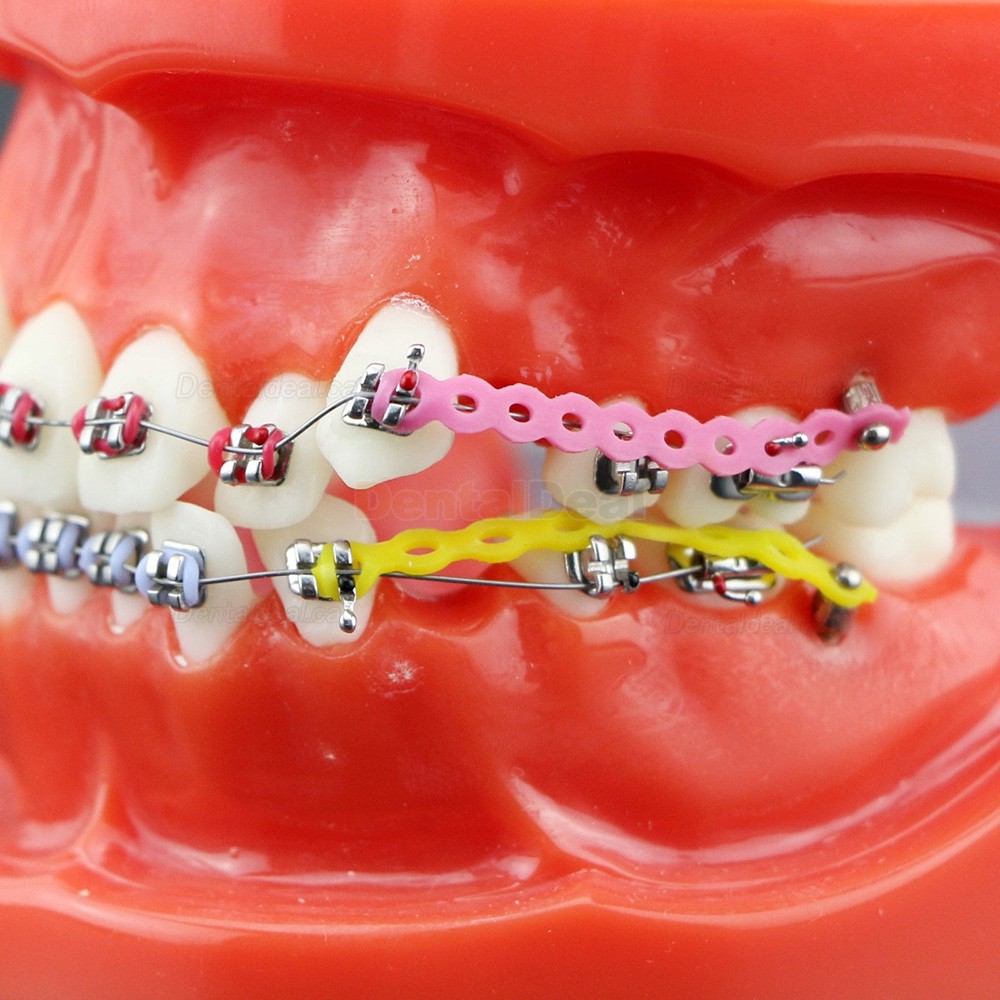 Dental Orthodontics Study Training Typodont Model With Metal Bracket Arch Wire Chain Tie 3005R