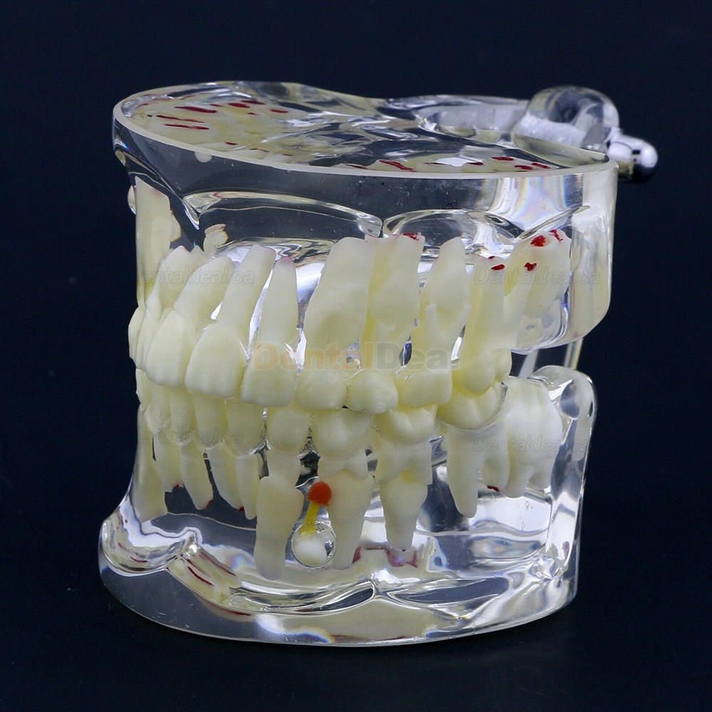 Dental Children Pediatric Pathology Demonstration Education Study Teeth Model 4002