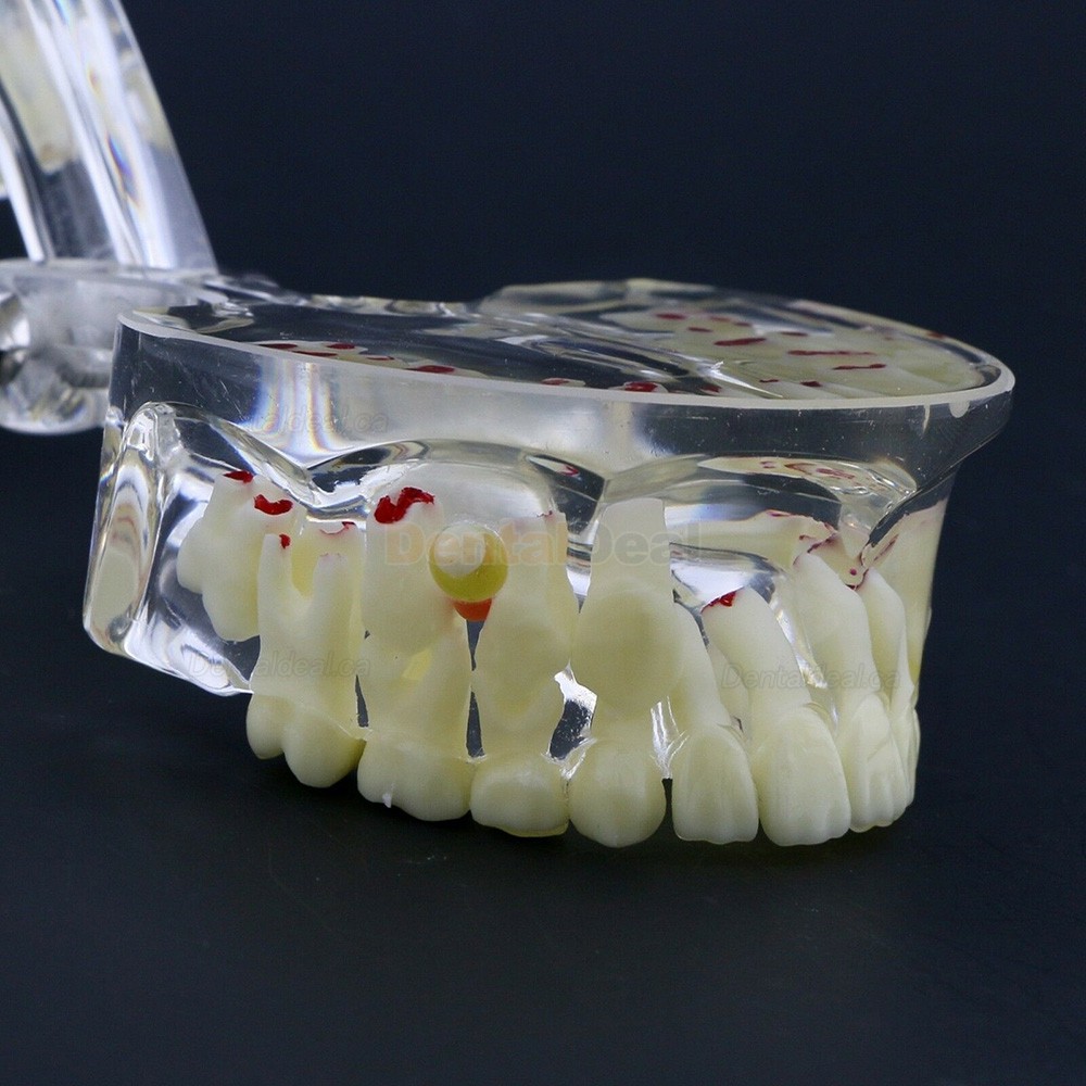 Dental Children Pediatric Pathology Demonstration Education Study Teeth Model 4002