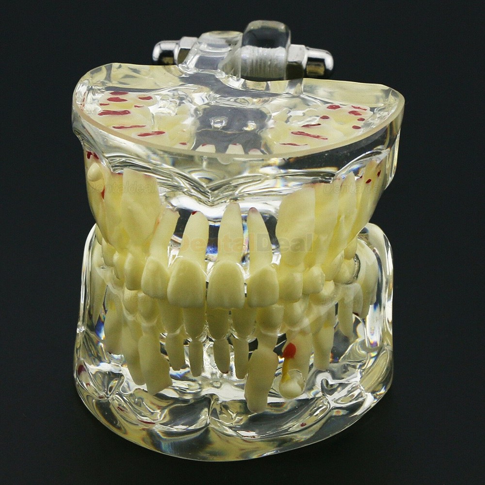 Dental Children Teeth Model Pediatric Demonstration Study Training Education Model 4002