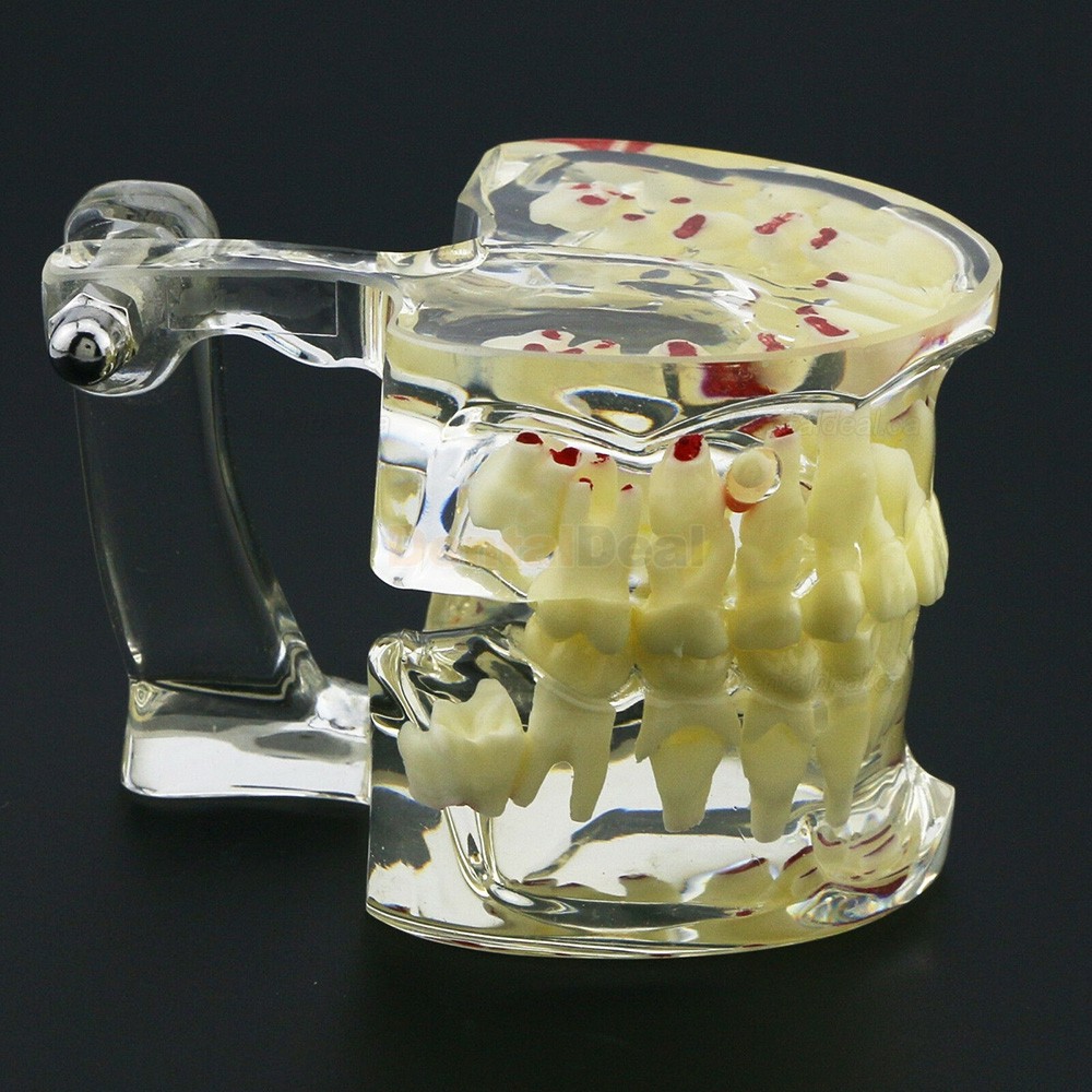 Dental Children Teeth Model Pediatric Demonstration Study Training Education Model 4002