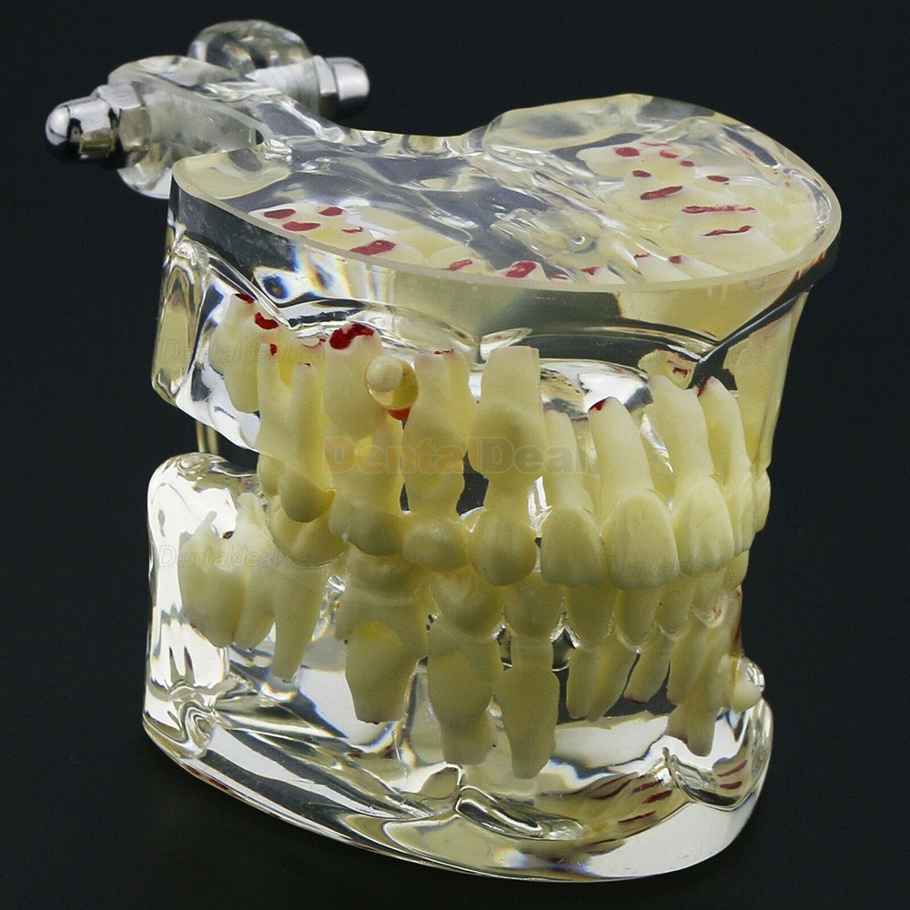 Dental Children Teeth Model Pediatric Demonstration Study Training Education Model 4002