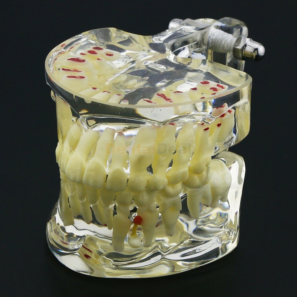 Dental Children Teeth Model Pediatric Demonstration Study Training Education Model 4002