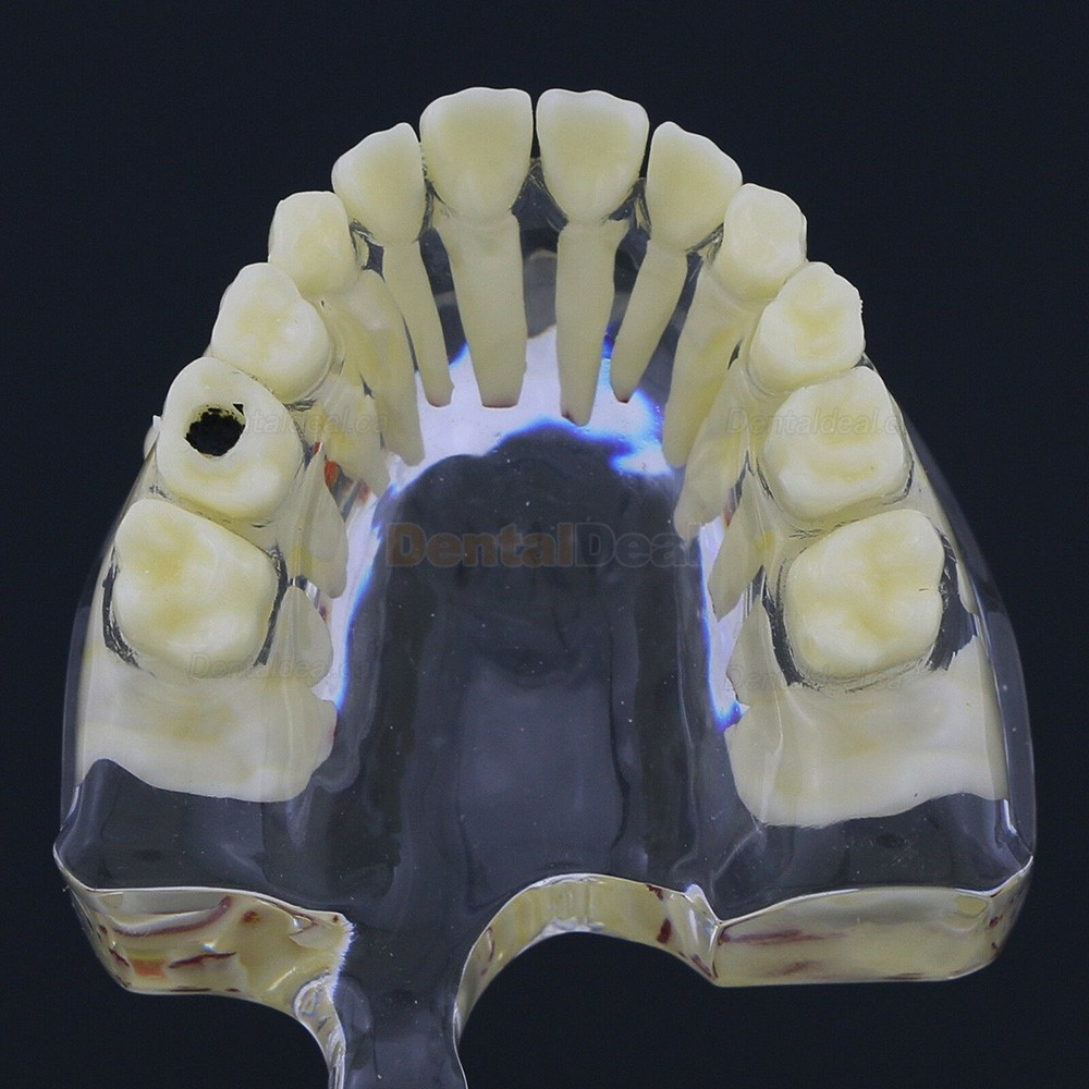 Dental Children Teeth Model Pediatric Demonstration Study Training Education Model 4002