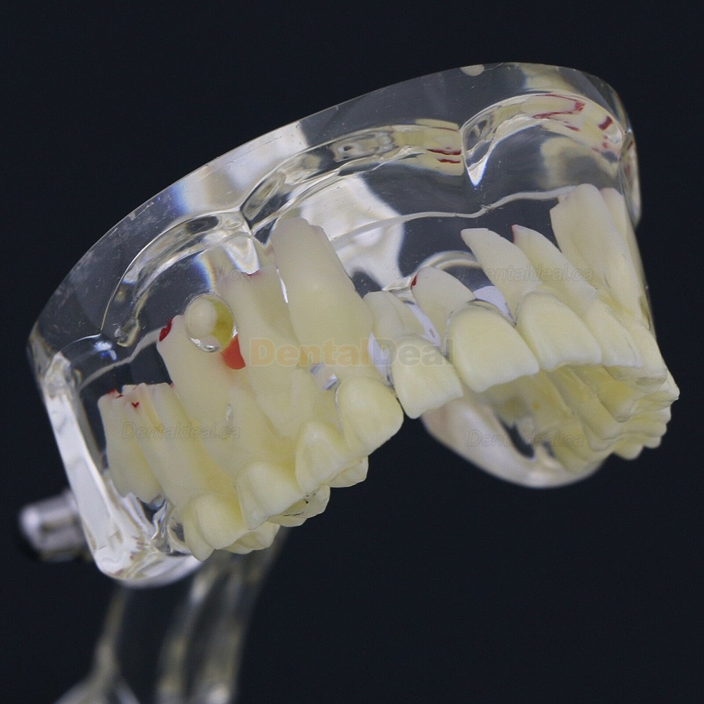 Dental Children Teeth Model Pediatric Demonstration Study Training Education Model 4002