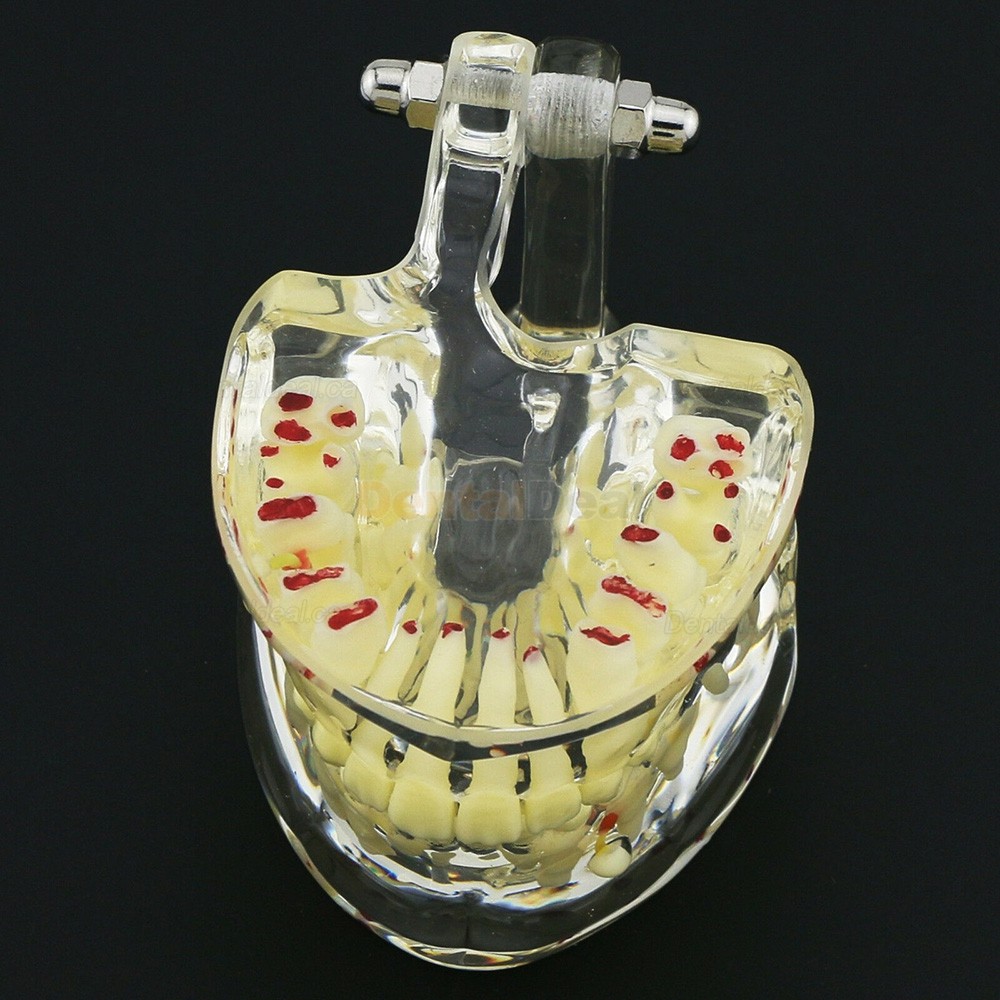 Dental Children Teeth Model Pediatric Demonstration Study Training Education Model 4002