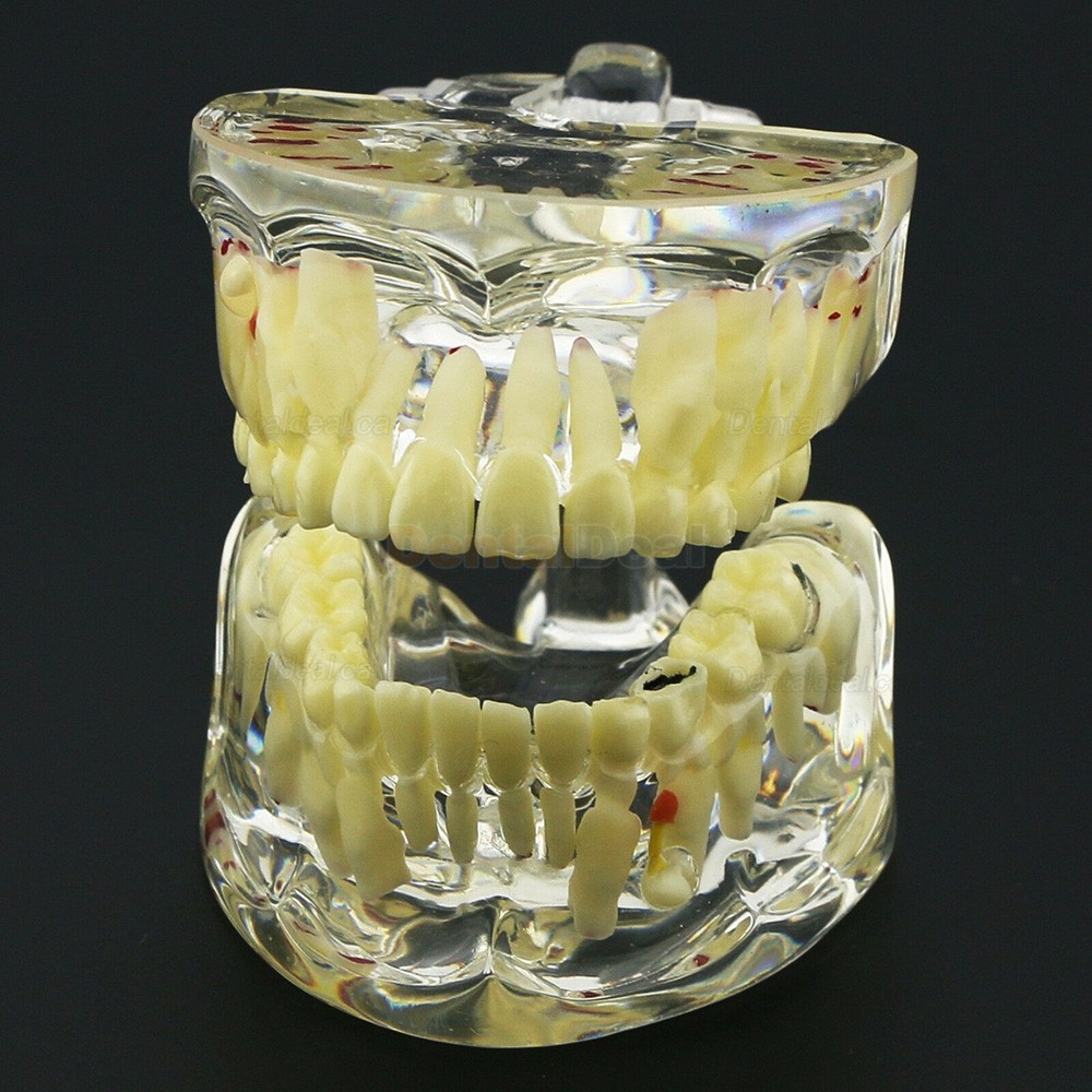 Dental Children Teeth Model Pediatric Demonstration Study Training Education Model 4002