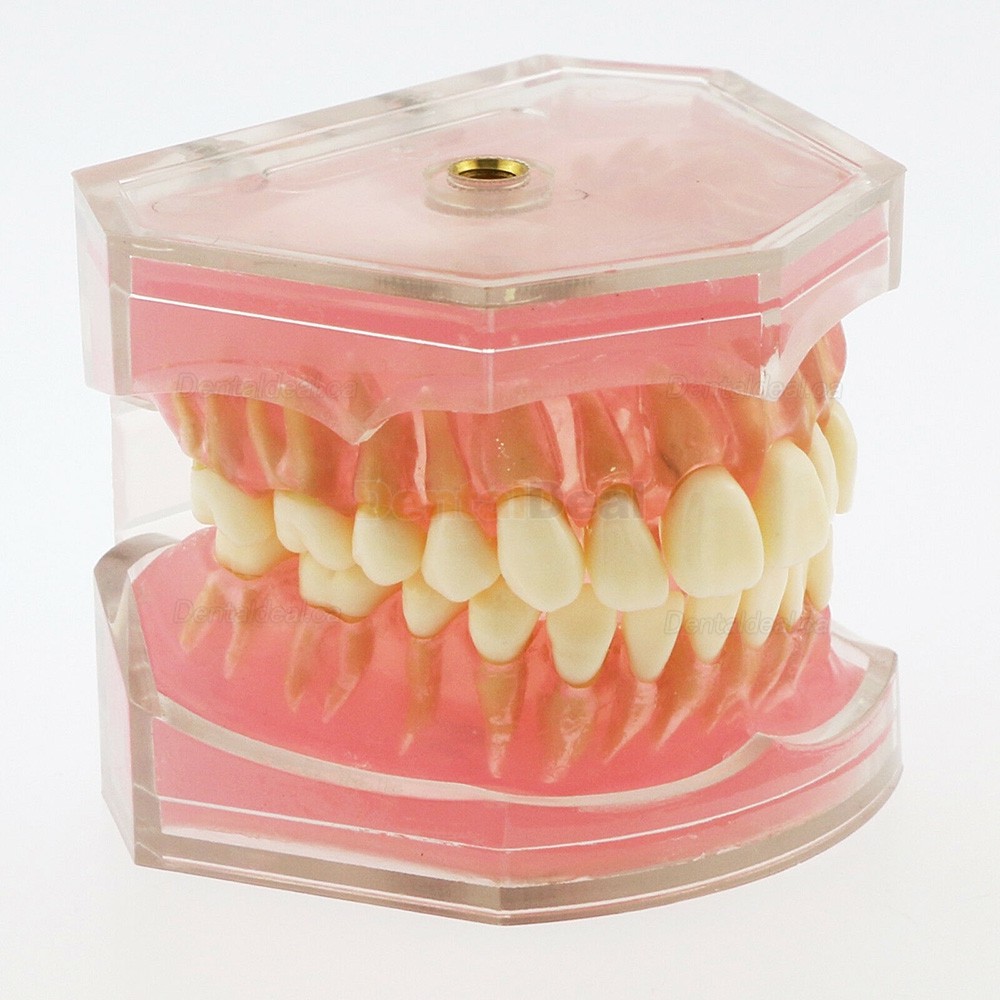 28Pcs Teeth Dental Removable Teeth Model Study Teach Standard Model 4004