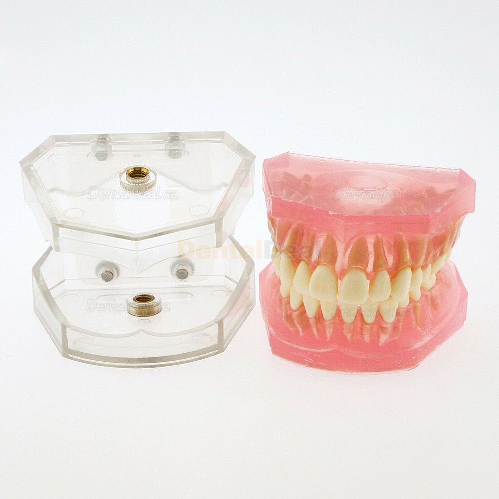 28Pcs Teeth Dental Removable Teeth Model Study Teach Standard Model 4004