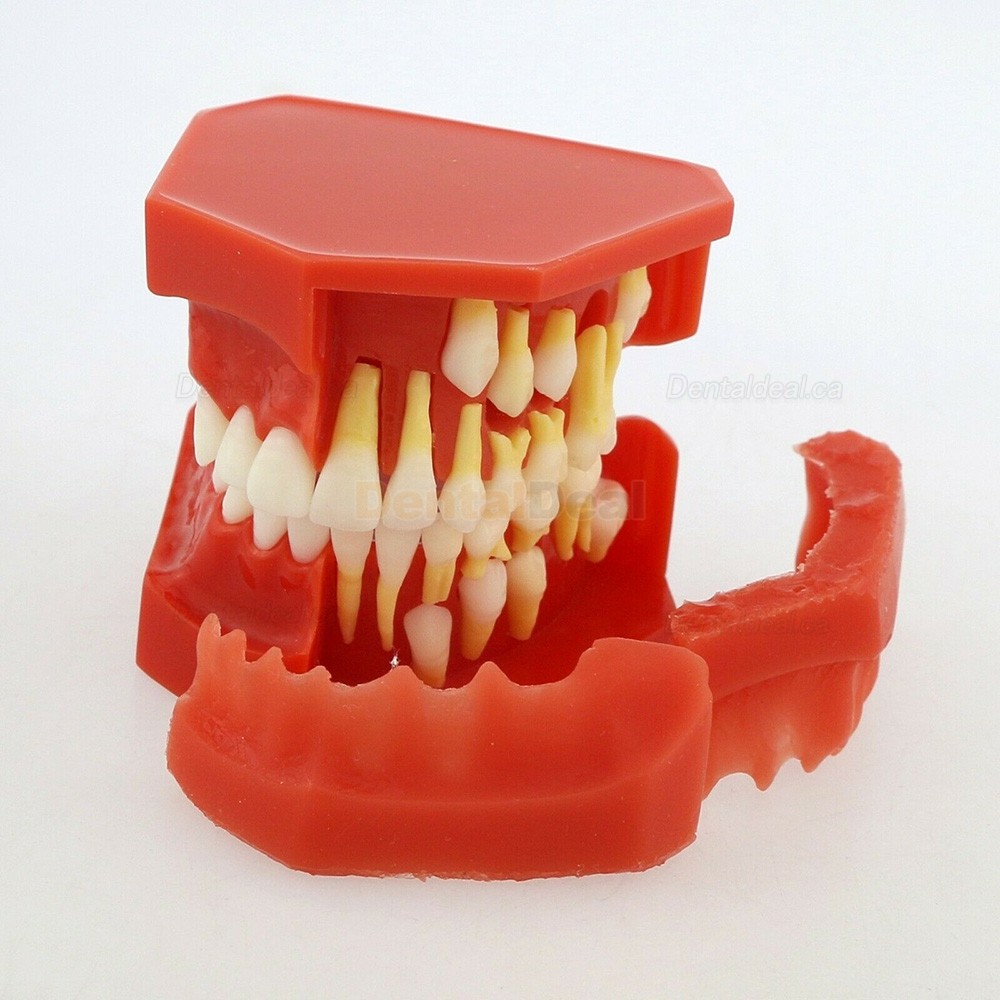Dental Teeth Model Permanent Tooth Demonstration Study Education Model 4006#