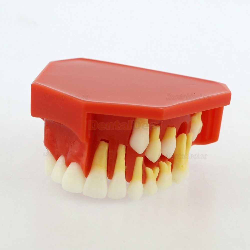 Dental Teeth Model Permanent Tooth Demonstration Study Education Model 4006#