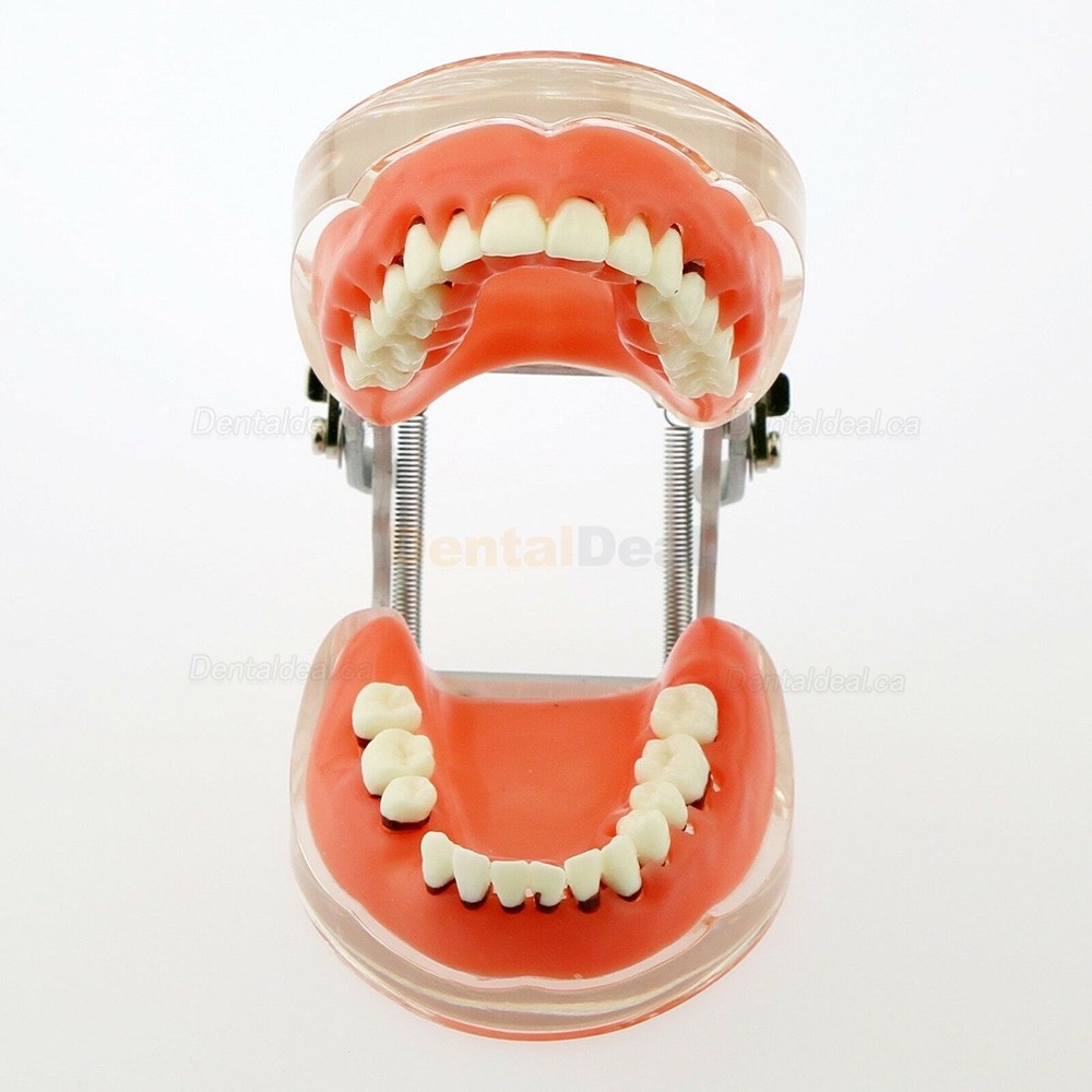 Dental Model Adult Periodontal Disease Study Demo Training Teeth Model 4017