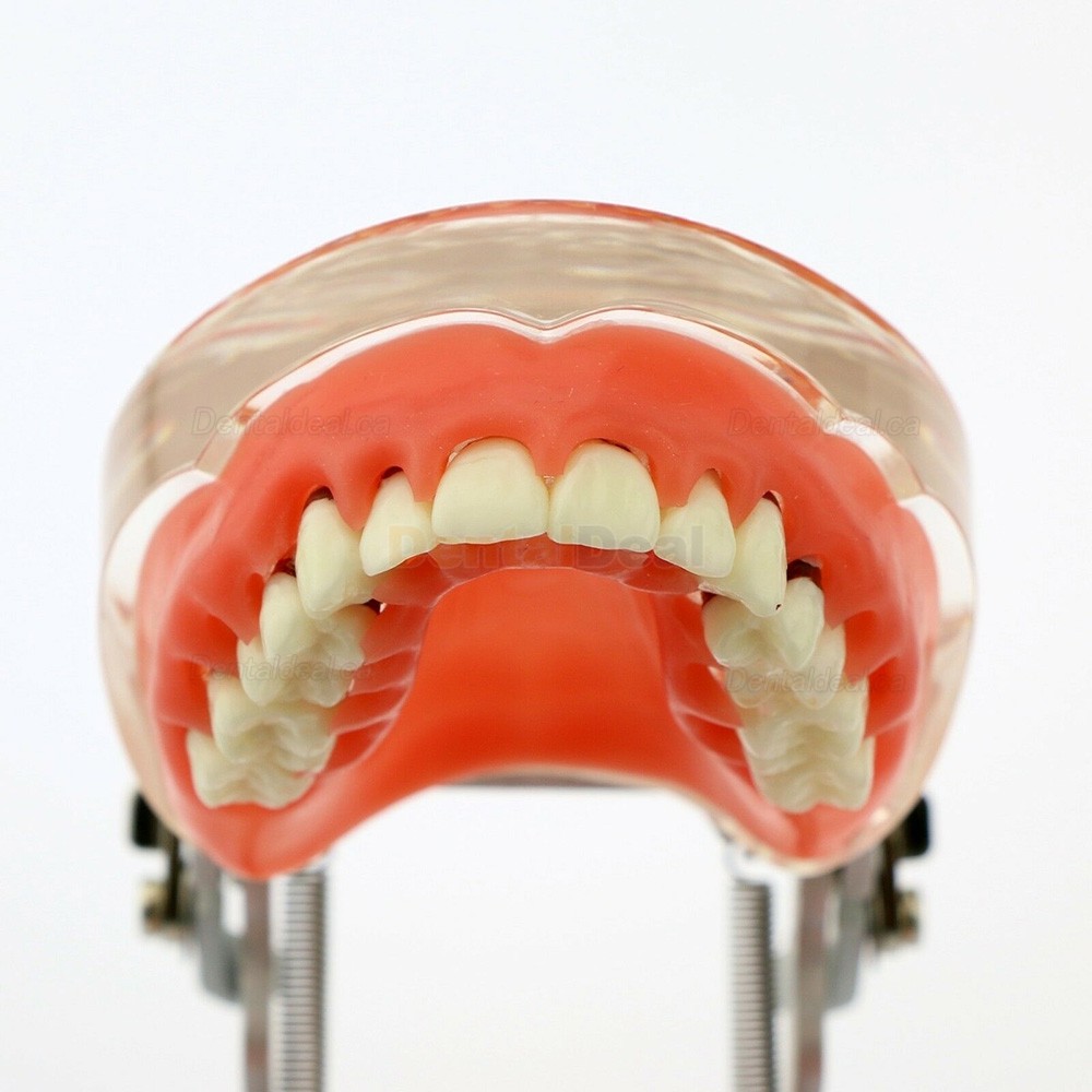 Dental Model Adult Periodontal Disease Study Demo Training Teeth Model 4017