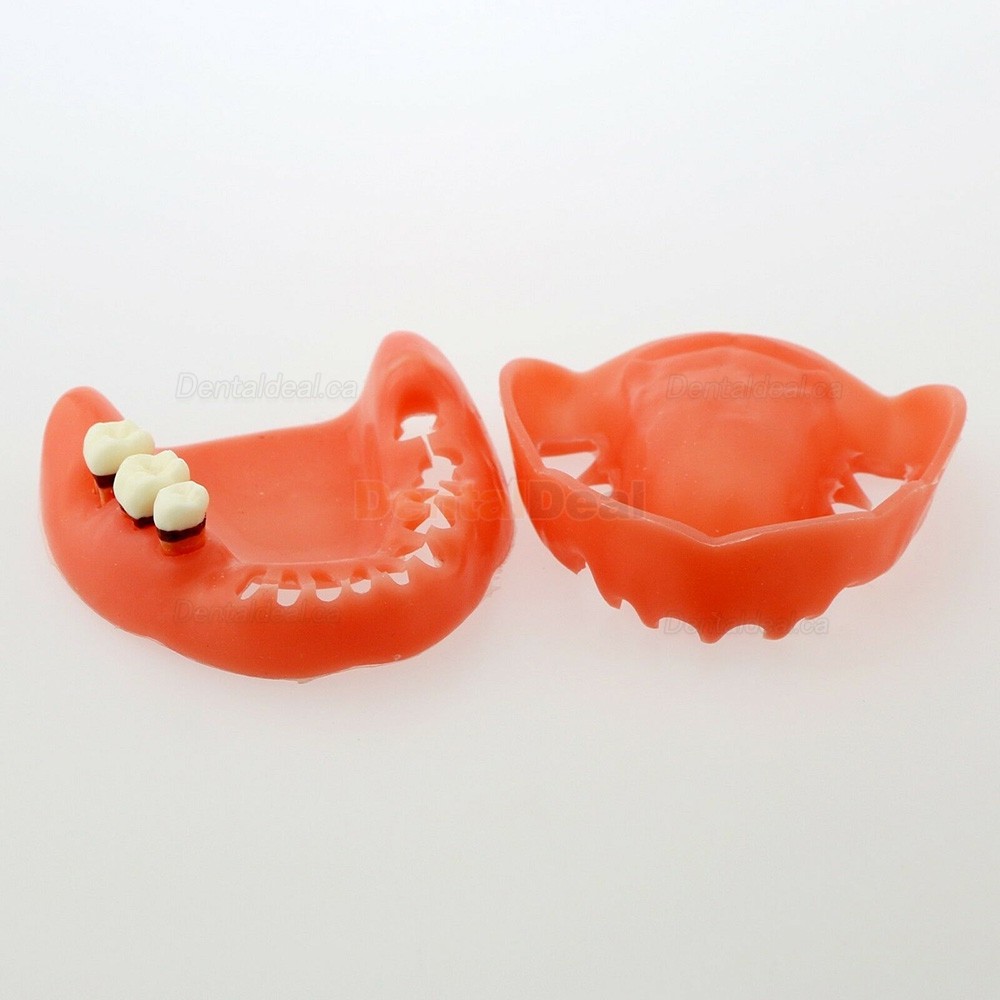 Dental Model Adult Periodontal Disease Study Demo Training Teeth Model 4017