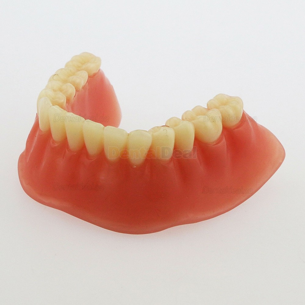Dental Implant Overdenture Model Lower Jaw with 4 Implants Silver Bar