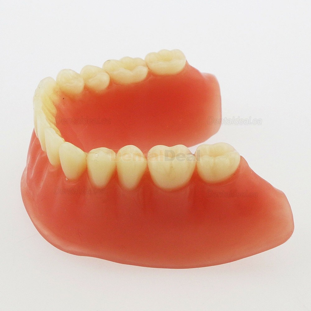 Dental Implant Overdenture Model Lower Jaw with 4 Implants Silver Bar