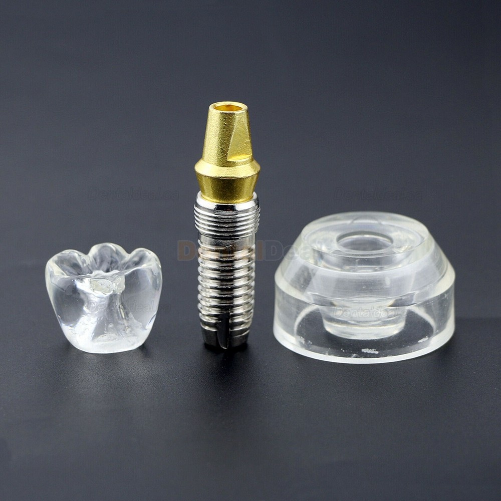 2.5x Size Dental Implant Model Demonstration Demo Model for Student Patient