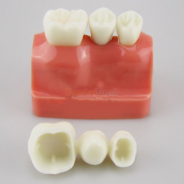 Dental Implant Demo Training Model for Students Patients M2017
