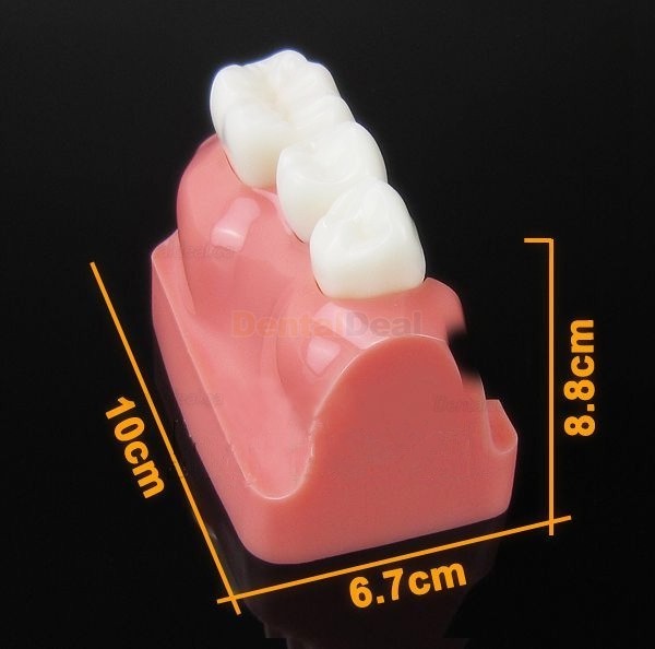 Dental Implant Demo Training Model for Students Patients M2017