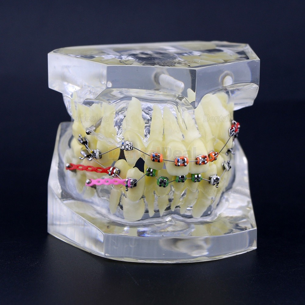 Dental Orthodontic Typodont Study Training Model With Metal Brackets