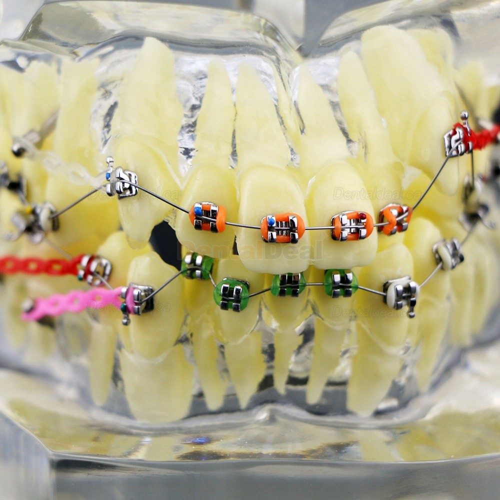 Dental Orthodontic Typodont Study Training Model With Metal Brackets
