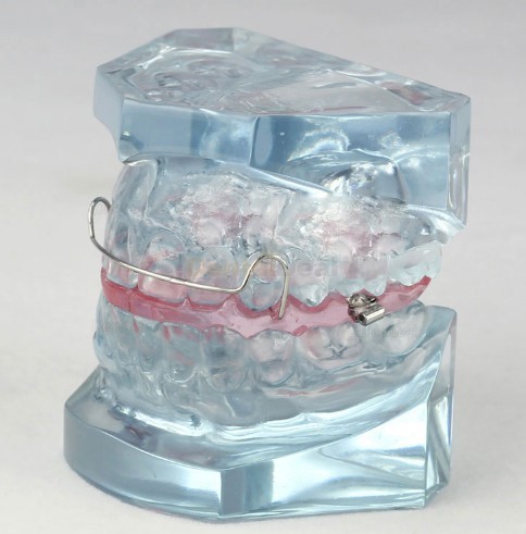 Orthodontic Demonstration Study Demo Education Model M3006
