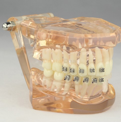 Dental Orthodontic Typodont Study Model with Ceramic Brackets M3009