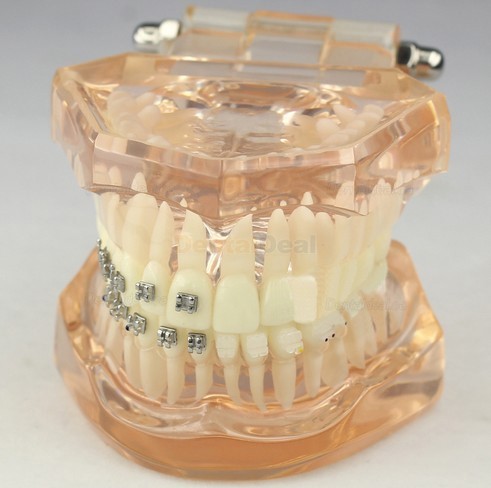 Dental Orthodontic Typodont Study Model with Ceramic Brackets M3009