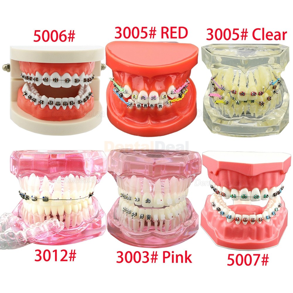 Dental Orthodontic Teeth Model with Metal Ceramic Bracket Tube Self-ligating Chain