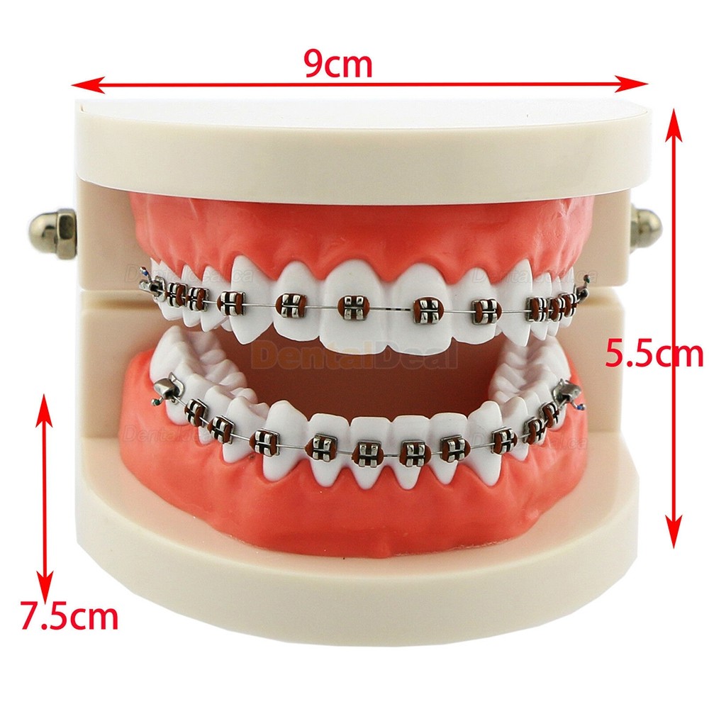 Dental Orthodontic Teeth Model with Metal Ceramic Bracket Tube Self-ligating Chain