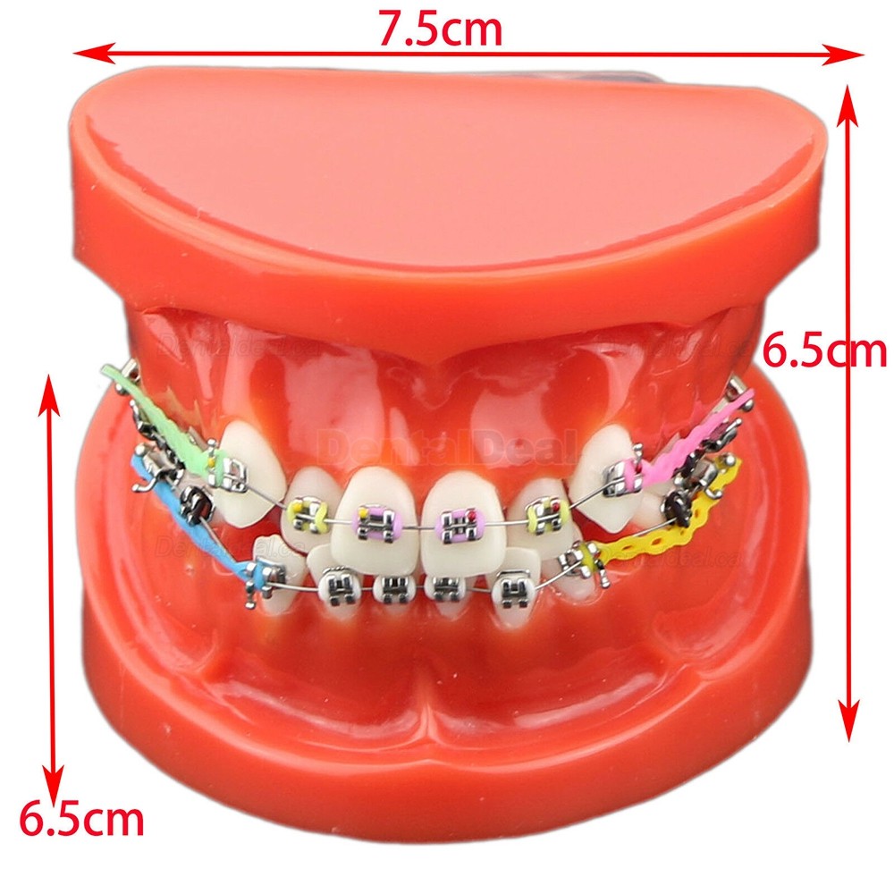 Dental Orthodontic Teeth Model with Metal Ceramic Bracket Tube Self-ligating Chain