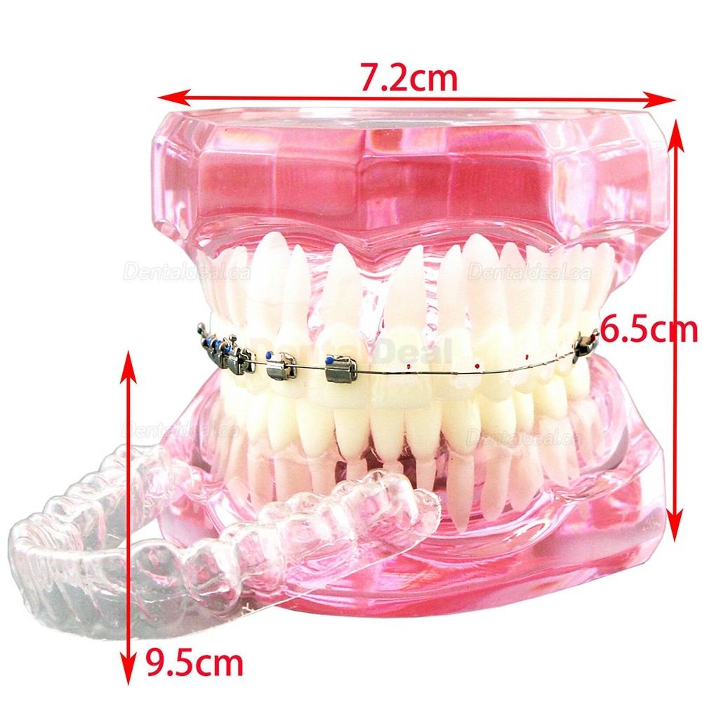 Dental Orthodontic Teeth Model with Metal Ceramic Bracket Tube Self-ligating Chain