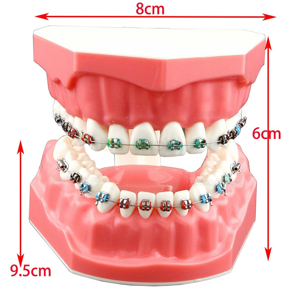 Dental Orthodontic Teeth Model with Metal Ceramic Bracket Tube Self-ligating Chain