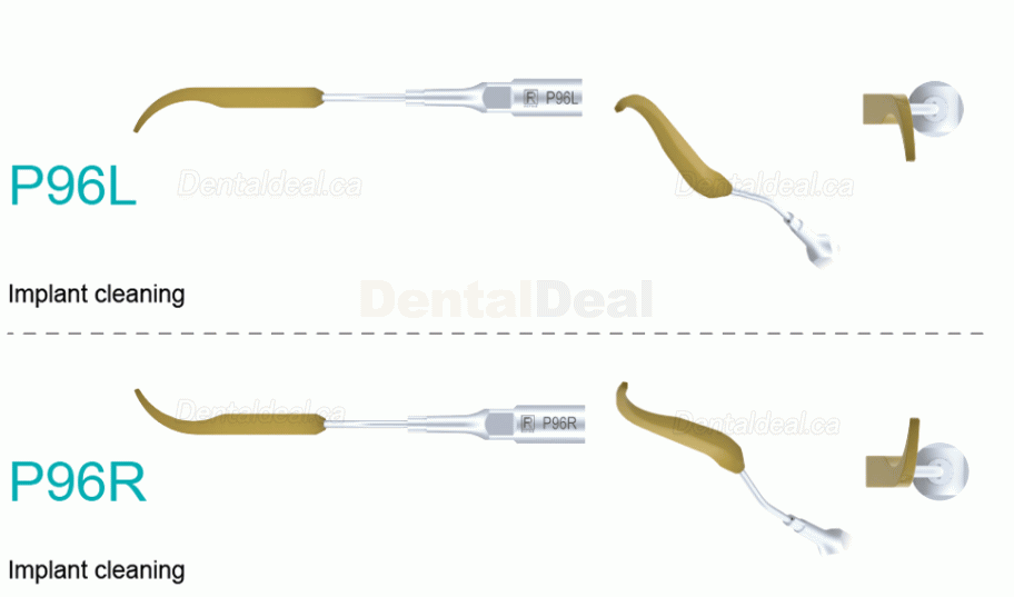 5Pcs Refine&reg; Ultrasonic Scaler Tips for Implant P90 P94 P95 P96L P96R Fit EMS MECTRON WoodPecker