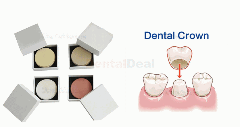 Dental Lab PEEK Block PEEK Disc 98mm/ 95mm 12/14/16/18/20/24/26mm