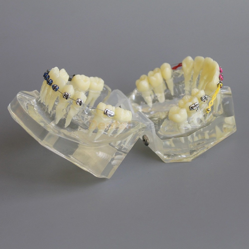 Dental Typodont Model Orthodontic Demonstration Practice Model With Metal Bracket Archwire